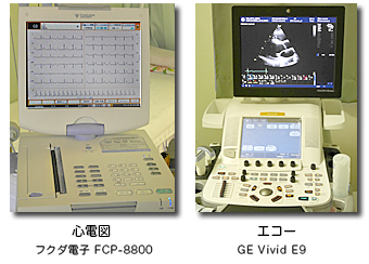 心電図フクダ電子FCP-8800、エコーGE Vivid E9